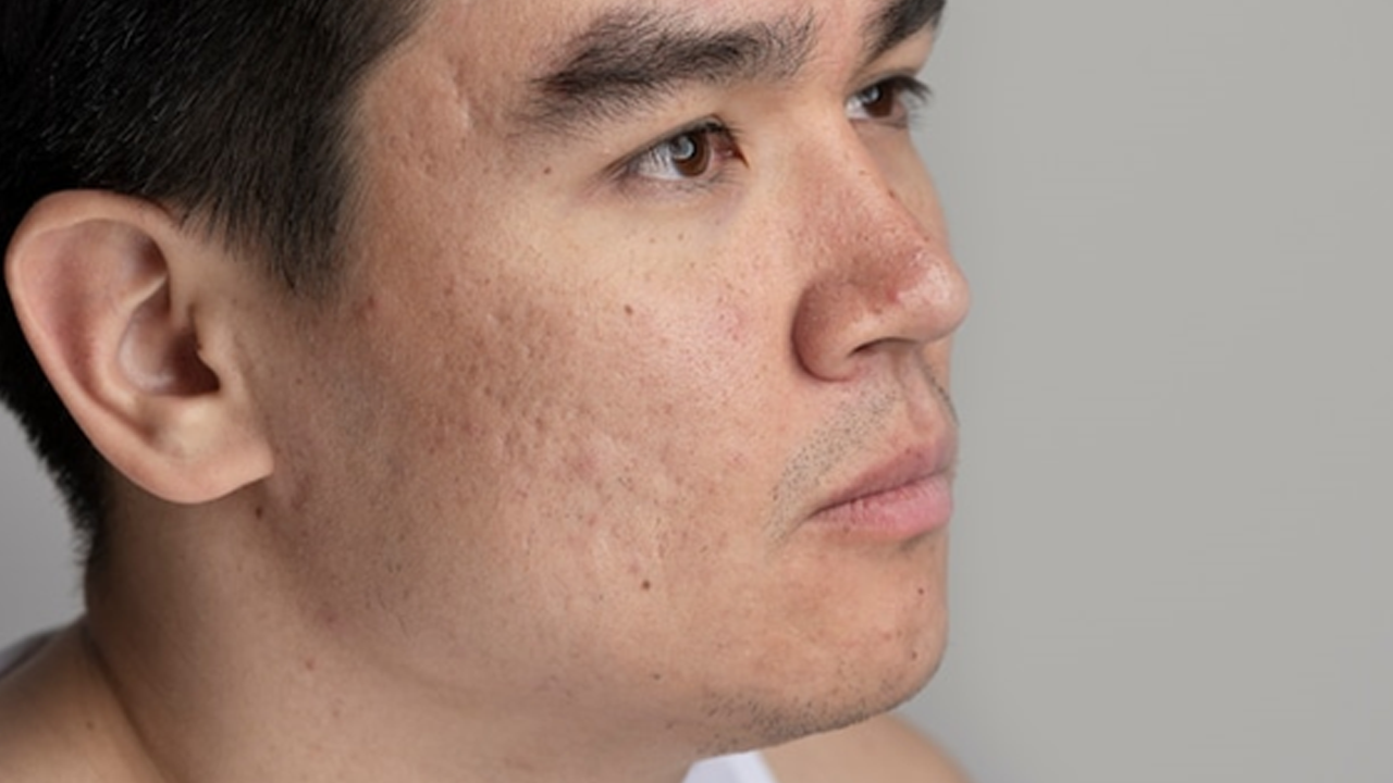 How to Minimize Pores: A Comprehensive Guide for Men
